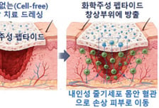 "이식 없이 피부 84% 재생"…아주대, 난치성 창상 치료 새 지평