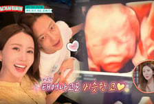 '임신 6개월' 이다해, 초음파 사진 공개 "코가 아빠 세븐 닮아"