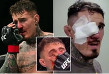 '역대급 비극' 실명 위기 반칙패→UFC 챔피언까지 뺏길 위기라니, 도대체 어떻게 이런 일이 "꼭 복귀하고 싶었는데..."