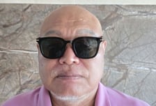 "머리 다 빠져"...김흥국, 탈모치료 모델 됐다
