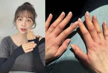 윤은혜 "온몸 퉁퉁 붓고 2주간 링거"…알레르기 고통 토로