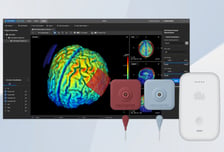 뉴로핏, 맞춤형 tDCS 솔루션 10개 병원 공급… 10월 비급여 적용