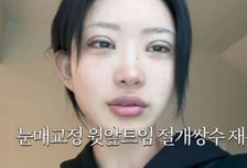 '故최진실 딸' 최준희, 쌍꺼풀 재수술에 눈 퉁퉁..."외모 정병 못 끊어"