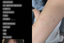"아빠, 제발 살려줘요" SOS...바지 벗겨진 딸, 학폭에 얼굴 퉁퉁