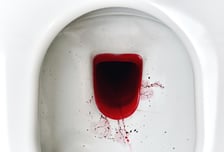 "치질 아닙니다" 배변 후 피 뚝뚝...항문암 부르는 HPV[한 장으로 보는 건강]