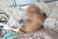 잠든 환자, 소화기로 내리쳐 살해...'망상 70대' 말리는 사람 없었다