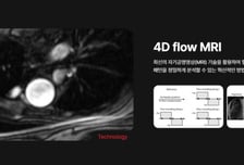 1시간 소요 '4D 플로우 MRI' 시간 단축…국제대회 1위 오른 기술