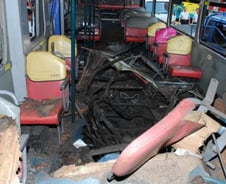 버스폭발 발목절단 20대女 접합수술 "일단 성공적" 