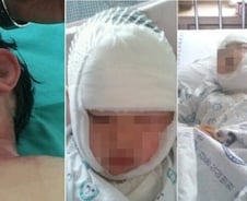 [단독]식당서 아이얼굴 화상 '된장국물녀' 결국…