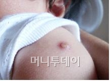 BCG백신, 공짜 외면하고 7만원짜리 맞는다