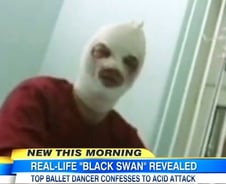 볼쇼이 발레단 감독 '황산테러', 여친 배역 불만 때문 