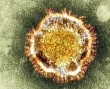 프랑스, 또 사스유사 환자...'사람간 전염' 우려 증폭