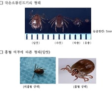 [단독]'살인진드기' 감염 의심 사망자 더 있을수도