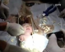 변기에 버려진 아기, 하수관 잘라내 '기적적 구출'