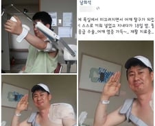 [단독]남희석, 왼쪽 어깨탈구 응급수술‥"재활 치료중"