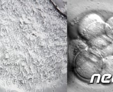 [단독] 줄기세포 투여 중 국내 첫 사망자 발생