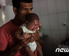 질본 "지카와 소두증 인과관계 검증 필요"