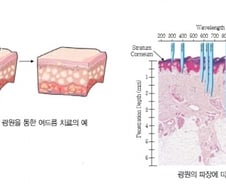 [MT리포트]LED는 어떻게 얼굴주름을 펼까