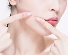 같은 곳에 계속 나는 뾰루지, 왜 이런 거죠?