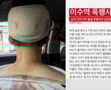 '이수역 폭행사건' 靑 국민청원 28만명 돌파