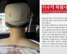 '이수역 폭행사건'은 왜 혐오논쟁이 됐나