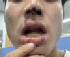 승리 클럽 '버닝썬' 폭행 논란…강남경찰서가 피해자 체포한 이유