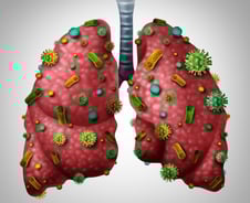 국내서도 확진된 '우한 폐렴'…예방 위해서는 