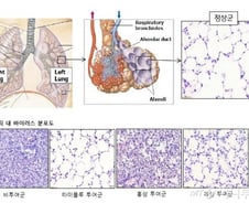 신종코로나 극성인데…홍삼보다 폐렴에 효과 2배 '이것'은?