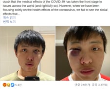 "너네 코로나 싫다" 런던 한복판서 폭행당한 아시아계 유학생