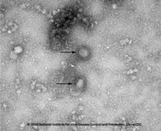 코로나19 임산부 출산 신생아 '음성'…"수직감염 가능성 낮아"