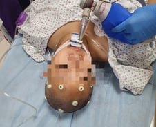 [단독]25세 여성 백신접종 후 '뇌출혈'…父 "내가 접종 강요했는데"