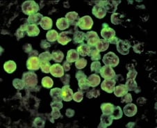 [검색폭발 이슈키워드] 파울러자유아메바