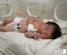 너의 이름은 '기적'… 생후 1주일 아야(Aya)에게