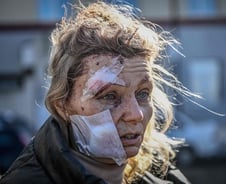 출혈 전쟁 1년의 기록…언제 어떻게 끝날지 누구도 모른다