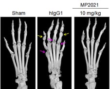 김성진 메드팩토 대표 "27조 휴미라 뛰어넘을 혁신신약 찾았다"