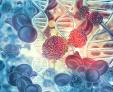 췌장암 생긴 한국인 '유전자 특성' 찾았다… 맞춤 치료 가능성↑