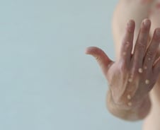 엠폭스 국내 확진자 15명 추가 발생, 누적 75명… 백신 접종 932명