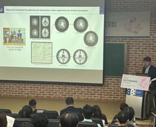 제이엘케이 인공지능 뇌졸중 솔루션 국내외서 '호평'