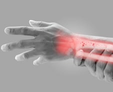 '구멍 송송' 약해진 뼈, 재채기에도 '뚝'…피검사로 치료 전략 세워야