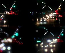 백내장 수술 앞둔 환자에 희소식…"휴대용 '모델 눈' 개발"