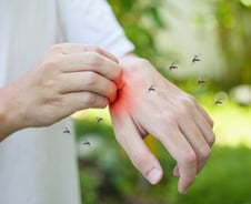 '윙윙' 소리 들리면 일반 모기…'말라리아 모기' 다른 점은?