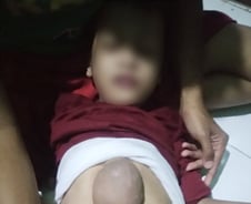 몸 바깥에 달린 심장, 7년 만에 가슴 속 '안착'…韓의료진이 해냈다