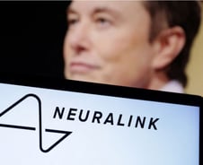 자폐·조현병 정복 꿈…'뇌에 칩 이식' 머스크의 뉴럴링크, 첫 임상모집