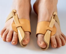 '하이힐 불청객' 무지외반증… 적게 절개해도 더 강해진 '이 치료법'