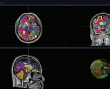 뷰노, 뇌 영상 판독하는 AI '뷰노메드 딥브레인' 기술 특허 등록