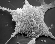 中 휩쓴 '낯선 감염병'…"한국도 환자 급증 하는 중" 대유행 경고