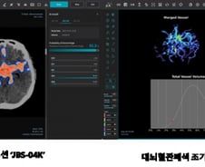 "내달부터 비급여 사용" 제이엘케이, '뇌졸중 AI 솔루션' 추가 상용화 '속도'