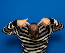 아토피 약 먹으면 머리도 풍성?…'원형탈모' 국내 임상시험 시작