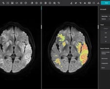 '의료AI 1호' 제이엘케이 "뇌졸중 '풀 솔루션'으로 글로벌 경쟁력 강화"