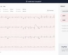 뷰노, AHA 2023서 AI 기반 심전도 연구 논문 4편 발표